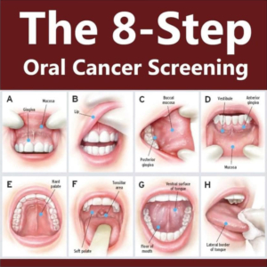 Oral cancer screening